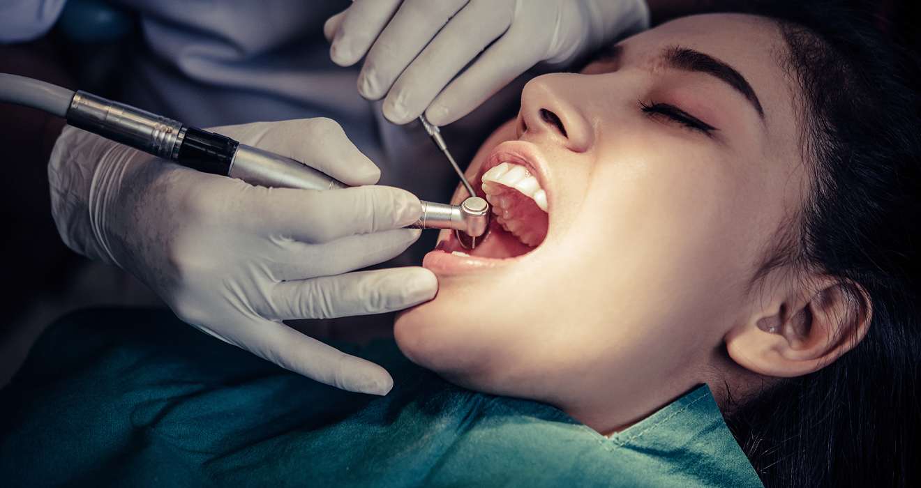 Laser Root Canal Treatment in Madipakkam